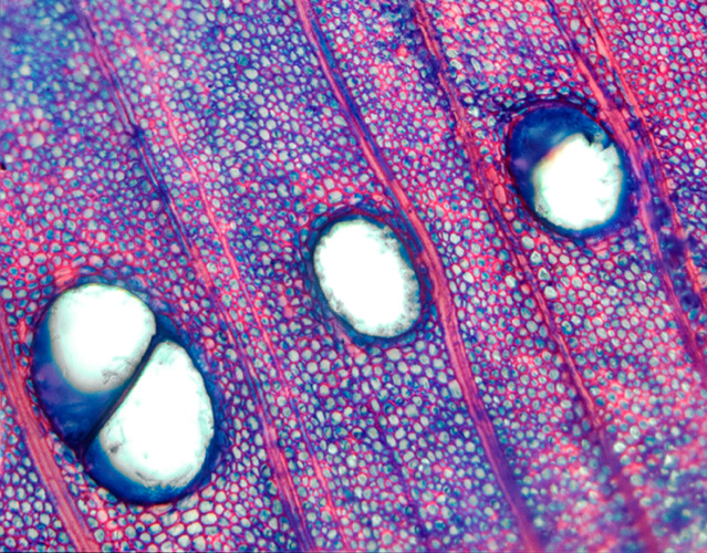Microfotografía de la madera de Albizia julibrissin